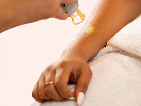 laser-hair-removal-treatment