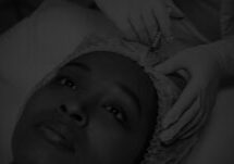 Dermal Filler Feat