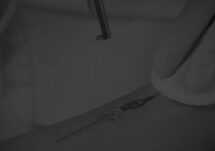 tattoo removal featured